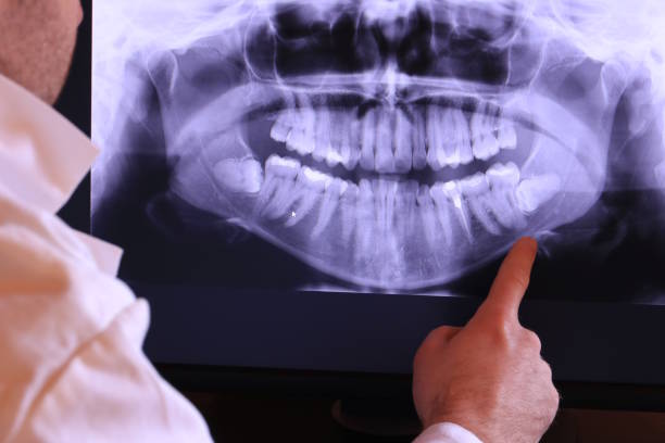 Best Emergency Root Canal Therapy in Flagtown, NJ