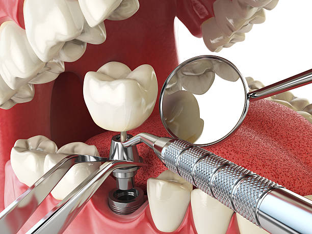 Best Emergency Dental Care for Sports Injuries in Flagtown, NJ